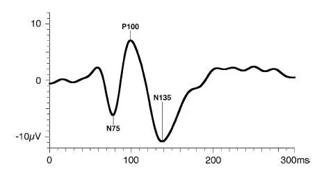 Clinical Visual Electrophysiology: Visual Evoked Potentials - American Academy of Ophthalmology