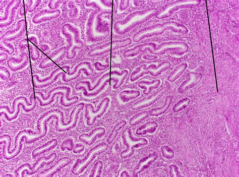 Histology Of Uterus Secretory Phase Diagram Quizlet | My XXX Hot Girl