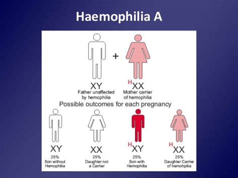 Hemophilia A: Hemophiliac Transmission Patterns —Viquepedia