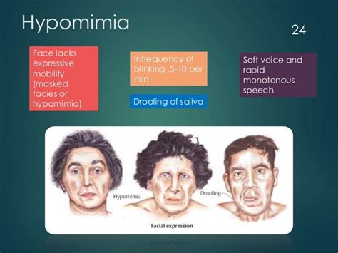 Parkinson’s disease