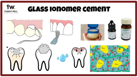 Glass ionomer cement simplified! - YouTube