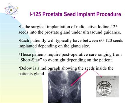 Rad Safety Inservice I 125 Prostate Seed Procedure