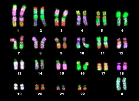 Fluorescence Lm Of A Normal Human Female Karyotype Photograph by Dept. Of Clinical Cytogenetics ...