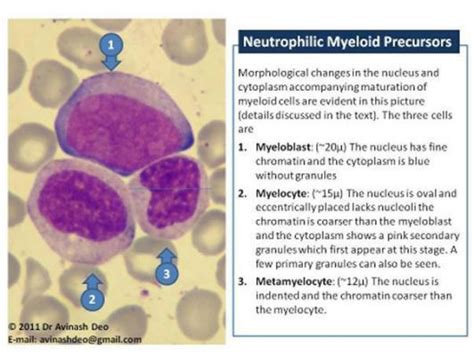 Morphology of Myeloid Precurssors | Hematology, Medical laboratory science, Medical technology