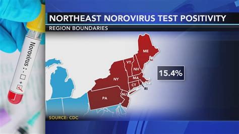 Stomach bug 2024: Contagious norovirus circulating in Northeast | Know ...