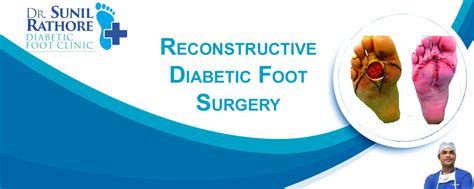 Reconstructive Diabetic Foot Surgery in Bhopal, Dr Sunil Rathore, India