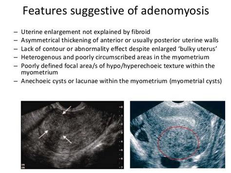 Basic gynae ultrasound