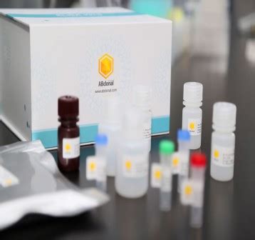 Human TNF-alpha ELISA Kit (RK00030) > 제품관리-Antibody | ㈜이노진텍