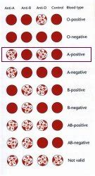 Blood Type Test | Determine Blood Type | CraigMedical