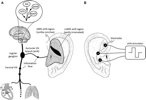 Vagus Nerve Stimulation