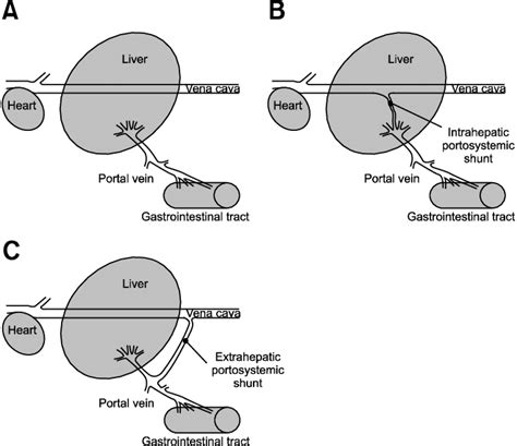 Simplified drawings illustrating types of portosystemic shunts. (A ...