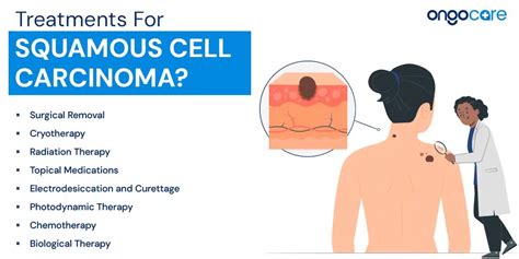 Squamous Cell Carcinoma: Understanding Its Risks and Treatment