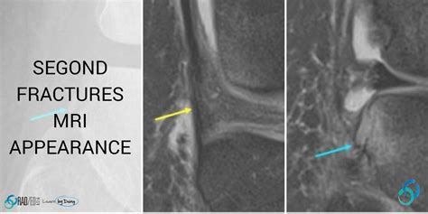 Images of MRI - JapaneseClass.jp