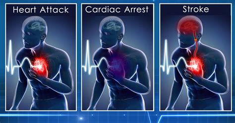 Awesomequotes4u.com: Difference between a Heart Attack, Cardiac Arrest and Stroke That You Must ...