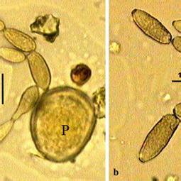 Conidiospores of Cladosporium spp. a chain of conidiospores on the... | Download Scientific Diagram