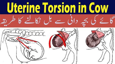 Uterine Torsion In Cow/ Twisting of Uterus/ Dr Ansar Malik - YouTube