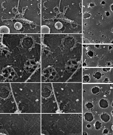 Figure 3 from The nuclear pore complex: three-dimensional surface structure revealed by field ...