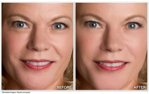 Revitol Anti Aging Cream Before and After Result No Photoshop #AntiAgingBeautyPro… | Anti aging ...