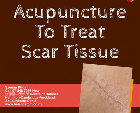 Scar Tissue Treatment Archives - Best Acupuncture Hamilton NZ