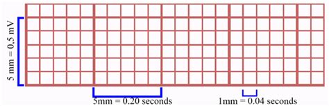 Basic Principles of the Electrocardiogram