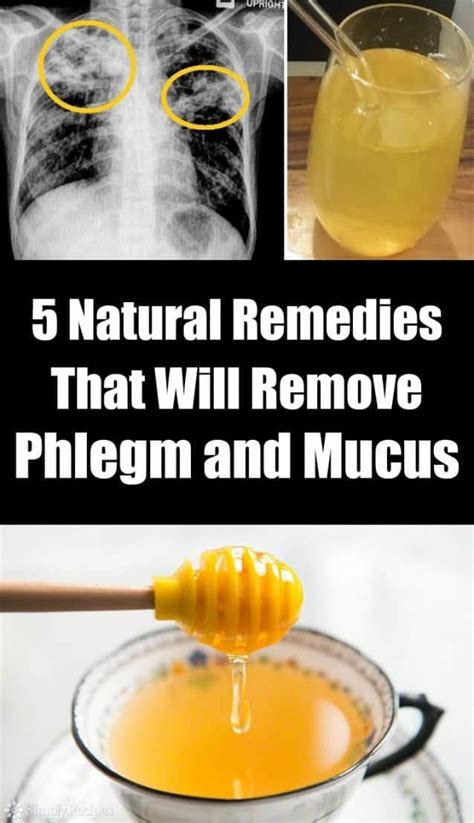 5 Natural Remedies That Will Remove Phlegm and Mucus