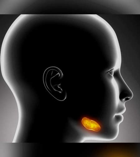 Jaw Cyst / Tumor Surgery - FMS DENTAL HOSPITAL