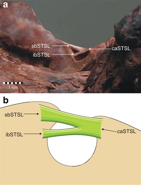 Superior Transverse Scapular Ligament