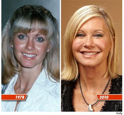 Celebrity Plastic Surgery Before & After (56 pics) - Izismile.com