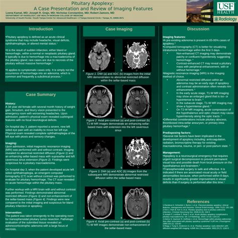 (PDF) Pituitary Apoplexy: A Case Presentation and Review of Imaging ...