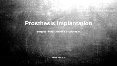 Medical vocabulary: What does Prosthesis Implantation mean - YouTube