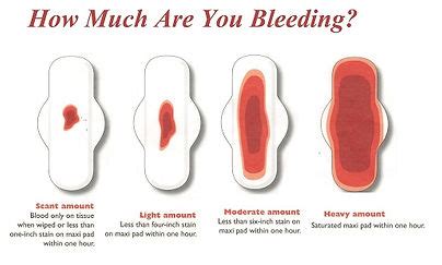 Symptoms of Miscarriage | Cork Miscarriage