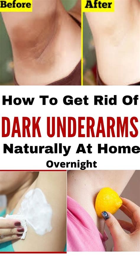 Top 15 Dark Underarms home remedies To Get Rid Of Fast | Trabeauli ...