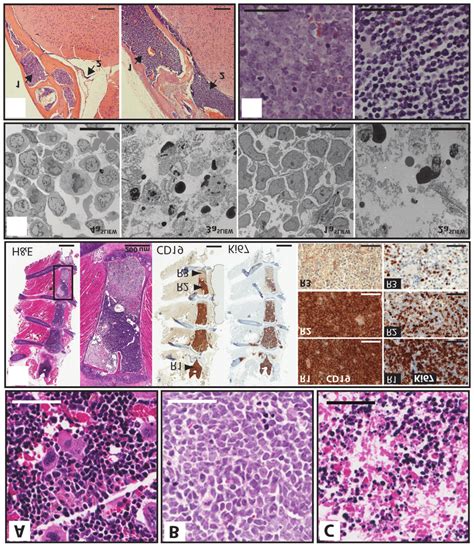 Bone Marrow Cells Histology