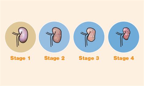 The International Renal Interest Society adds the IDEXX SDMA Test to chronic kidney disease ...