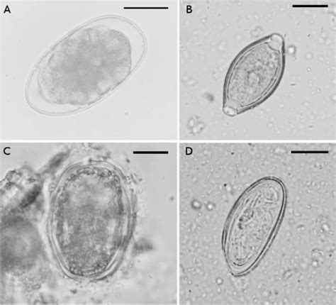 (A) Hookworm egg. (B) Trichuris trichiura egg. (C) Ascaris sp. egg. (D)... | Download Scientific ...