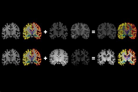 From one brain scan, more information for medical artificial intelligence