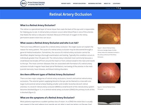 Retinal Artery Occlusion - Retina-Vitreous Surgeons of CNY