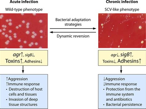 Scheme of dynamic SCV development in the course from acute to chronic... | Download Scientific ...