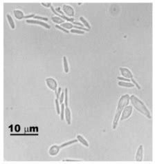 Sporothrix - Phylogeny, Habitat, Dangers and Treatment