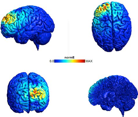 Using Magnets to Stimulate the Brain Helps People With Depression · Frontiers for Young Minds