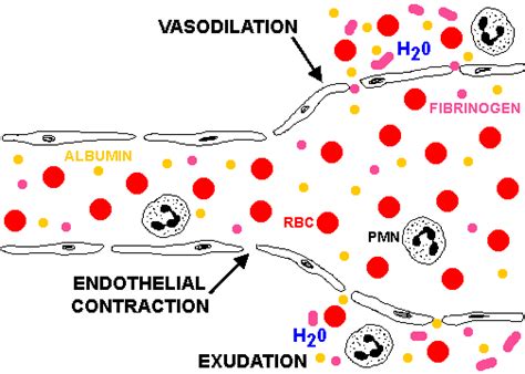 Inflammation