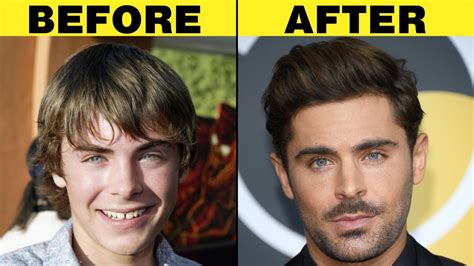 15 Most AMAZING Celebrity Glow Ups - YouTube