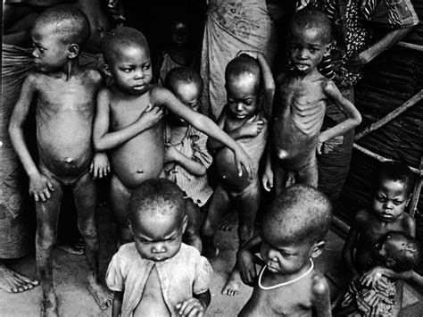 Hunger and Starvation Affecting Half the Human Race Across the Globe