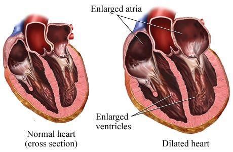 ConceptoDefinición | Cardiomegalia - ConceptoDefinición