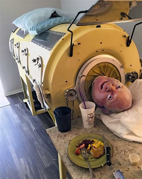 Paul Richard Alexander: Living in an Iron Lung for 70 Years - Malevus