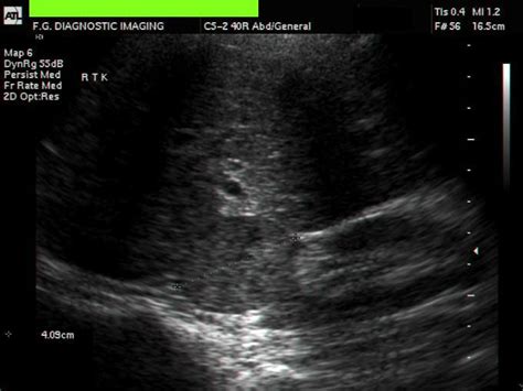 A Gallery of High-Resolution, Ultrasound, Color Doppler & 3D Images ...