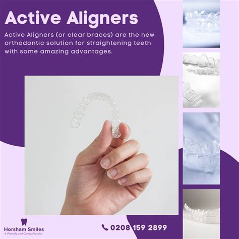 Active Aligners | Cosmetic dentist, Smile dental, Dental clinic