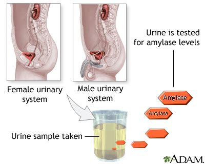 Amylase urine test: MedlinePlus Medical Encyclopedia Image