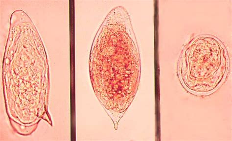 Good review of Schistosoma | Medical Laboratories