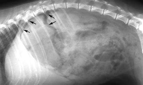 Gastrointestinal Perforation